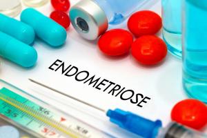 L'endométriose affecte 190 millions de femmes dans le monde. En identifiant une cause génétique de la maladie, ces chercheurs révèlent une nouvelle cible possible de traitement (Visuel Adobe Stock 126345857) 