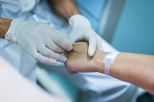 C’est un lien génétique qui vient d’être découvert entre une carence en fer et la maladie de Crohn (Visuel Adobe Stock 158171447)