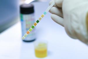 Le diagnostic précoce du cancer de la vessie ou de sa récidive, sera très prochainement facilement accessible à domicile (Visuel Adobe Stock 163155094)