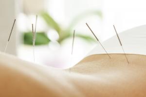 Au stade du prédiabète, l'acupuncture peut être une thérapie, non médicamenteuse mais efficace contre le développement du diabète de type 2 (Visuel Adobe Stock 166030227).