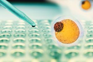 Le cholestérol n'est en effet pas le seul lipide impliqué dans les maladies cardiovasculaires liées aux acides gras trans (Visuel Adobe Stock 185077367)