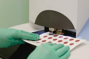 C’est une nouvelle méthode de test rapide qui va faciliter considérablement le diagnostic des maladies rares chez les nourrissons et les enfants (Visuel Adobe Stock 214781210)