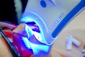 Si le blanchiment dentaire est donc bien un traitement esthétique, il n’en requiert pas moins l’expertise clinique de praticiens qualifiés, spécialisés et formés à la technique du blanchiment.