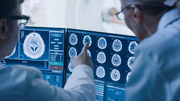 Plusieurs équipes de recherche travaillent à des formes d’immunothérapie pour la maladie d’Alzheimer (Visuel Adobe Stock 236237463)