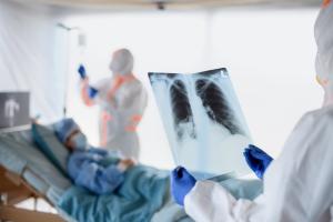 Un tiers des patients hospitalisés pour une forme grave de COVID-19 présentent toujours des anomalies pulmonaires un an plus tard (Visuel Adobe Stock 331045992)