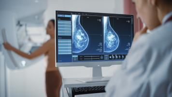 C’est le premier essai randomisé à confirmer que le dépistage par mammographie assisté par l'intelligence artificielle (IA) est sûr et réduit de près de moitié la charge de travail des radiologues (Visuel Adobe Stock 422714239)