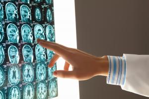 La pauvreté durant l'enfance peut entraîner des changements dans le cerveau (Visuel Adobe Stock 53279483)