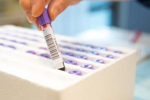 Ce test pourrait même révolutionner la façon dont les médecins préviennent les crises cardiaques et les accidents vasculaires cérébraux (AVC) en identifiant les patients les plus susceptibles de bénéficier de médicaments de prévention.(Visuel Adobe Stock 61724653)