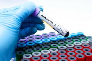 En 2022, le paludisme a causé plus de 620.000 décès dans le monde, ce qui fait de Plasmodium falciparum, le parasite le plus virulent, le plus répandu et le plus mortel (Visuel Adobe stock 631438592)