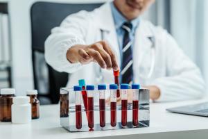 Les scientifiques se rapprochent enfin d'un test sanguin qui pourrait détecter des millions de propagations silencieuses de la tuberculose (Visuel Adobe Stock 640031876)