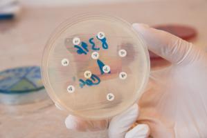 C'est l'espoir l’espoir du développement d’un vaccin contre l’infection à Campylobacter jejuni, une bactérie responsable d'entérite et de septicémie parfois (Visuel Adobe Stock 95277279)