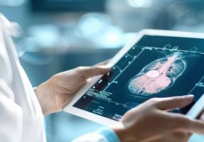 La radiothérapie, plutôt que la chirurgie, pourrait contribuer à réduire le risque de lymphœdème chez certaines patientes atteintes d'un cancer du sein (Visuel Adobe Stock 973248349)