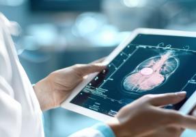 Après la ménopause, environ 40 % des cancers du sein hormonaux positifs liés à un excès de graisse corporelle (Visuel Adobe Stock 973248349)