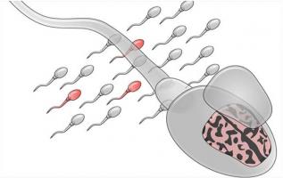 Pouvoir détecter certaines mutations dans le sperme du père pourrait permettre de révéler un risque d'autisme chez ses futurs enfants