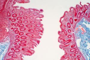 La toxine produite par E. coli modifie l'expression des gènes dans les cellules qui tapissent l'intestin, les induisant à produire une protéine que la bactérie utilise ensuite pour se fixer durablement à la paroi intestinale (Visuel Fotolia)