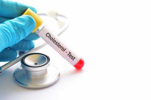 En complément du cholestérol LDL le test de la protéine ApoB peut fournir un marqueur plus précis du risque de maladie cardiaque (Visuel Adobe Stock 176284606)