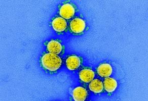 Cette petite molécule, découverte par une équipe de l’Université de Hong Kong présente une grande particularité : elle inhibe plusieurs virus différents, dont le SRAS-CoV-2 (Visuel NIAID)