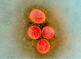 Le coronavirus utilise une enzyme pour modifier la coiffe de son ARN messager et se dissimuler ainsi du système immunitaire (Visuel NIH) 