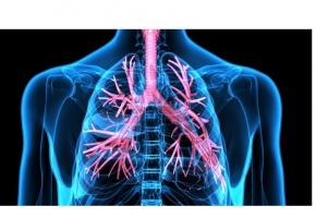 L'asthme lié à obésité serait en plus de l'inflammation pulmonaire, lié au rétrécissement des voies aériennes