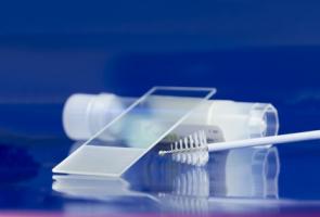 Ce nouvel auto-test HPV pourrait améliorer significativement le dépistage du cancer du col de l'utérus (Visuel Fotolia 178724702)
