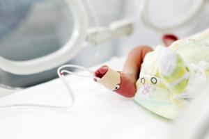 Les incubateurs (ou couveuses) de soins intensifs néonatals produisent des résonnances qui risquent d'endommager l'ouïe des bébés prématurés (Visuel Fotolia 48753935)