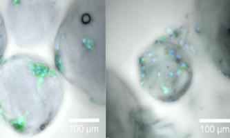 Des gouttes de gel de la taille d'un micromètre peuvent fournir l'architecture extracellulaire nécessaire, en médecine régénérative, à la croissance et à la prolifération des cellules au cours de la cicatrisation (Visuel 2021 KAUST ; Gustavo Ramírez Calderón.)