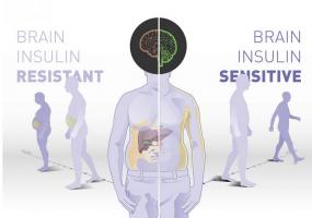 Les personnes ayant une sensibilité cérébrale élevée à l'insuline bénéficient beaucoup plus d'une intervention sur le mode de vie comportant un régime alimentation riche en fibres et la pratique de l’exercice