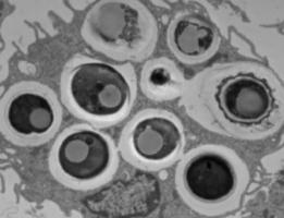 La levure D. hansenii contribue à la MICI en augmentant les niveaux d'une cytokine spécifique appelée CCL5 (chimiokine ligand 5) (Visuel Cleveland Clinic) 