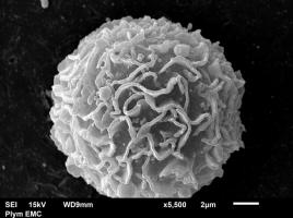 Ces travaux ouvrent la possibilité de cibler et de supprimer sélectivement les cellules pro-inflammatoires responsables de la maladie. 