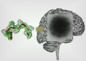 Un auto-assemblage peptidique, « à poils », va délivrer l'agent actif dans le cerveau