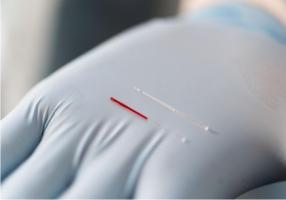 Cette technique mini-invasive d'échantillonnage du fluide corporel humain qui pourrait être une nouvelle source de données pour la surveillance clinique de routine (Visuel Allison Carter, Georgia Tech) 