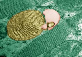 Les mitochondries défectueuses sont englouties par « l'autophagosome » (Visuel Julio C. B. Ferreira/USP)