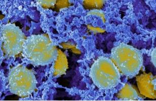 Comment les neutrophiles et les macrophages, deux outils essentiels à la réponse immunitaire innée coopèrent pour capturer et « manger » les bactéries (Visuel NIH)