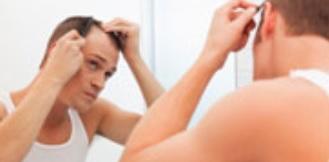 Près de 70% des hommes sont touchés par une calvitie ou alopécie androgénétique
