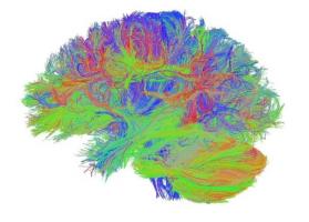 Le connectome illustre les connexions entre les différentes zones cérébrales.