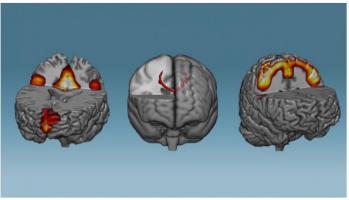 Ces scientifiques ont mis au point une technique d’entraînement cérébral capable d’induire des modifications des réseaux de neurones… en moins d’une heure. 