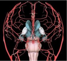 Les patients atteints de fibromyalgie présentent des anomalies du flux sanguin cérébral