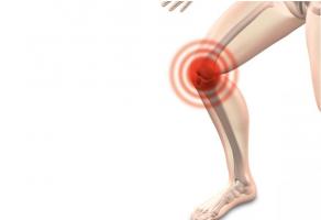 C’est un nouveau « lubrifiant » : il est synthétique et prometteur pour soulager les articulations en cas d’arthrose du genou. 