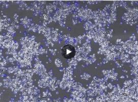 L'indice de mouvement des colonies de kératinocytes oraux prédit la capacité de régénération épithéliale (Vidéo Scientific Reports) 