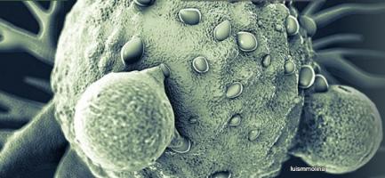 HIPP cible CtBP déclenche le développement de cellules souches cancéreuses, qui sont à l’origine des polypes