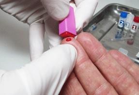 Le nombre élevé de personnes vivant avec un VIH non diagnostiqué appelle à un meilleur dépistage du VIH en Europe