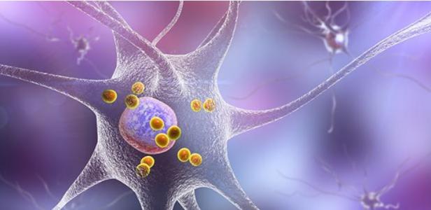Les cellules T qui réagissent à l'alpha-synucléine sont plus abondantes lorsque les patients sont diagnostiqués pour la première fois avec la maladie. Les cellules T qui réagissent à l'alpha-synucléine sont plus abondantes lorsque les patients sont diagnostiqués pour la première fois avec la maladie.