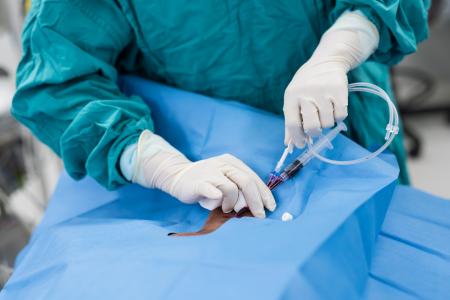Ce cathéter innovant promet de prévenir les infections sanguines, en particulier celles associées aux cathéters centraux qui tuent chaque année des milliers de personnes dans le monde (Visuel Adobe Stock 113461339) Ce cathéter innovant promet de prévenir les infections sanguines, en particulier celles associées aux cathéters centraux qui tuent chaque année des milliers de personnes dans le monde (Visuel Adobe Stock 113461339)