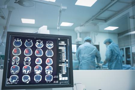 Un mini-AVC peut-il entraîner une fatigue durable ? (Visuel Adobe Stock 123251630) Un mini-AVC peut-il entraîner une fatigue durable ? (Visuel Adobe Stock 123251630)