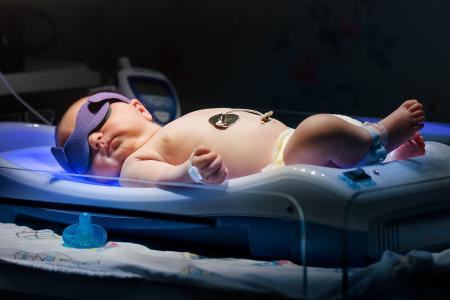 Un bébé sur 8 est génétiquement protégé contre la jaunisse ou ictère du nouveau-né (Visuel Adobe Stock 143179458)