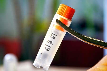 L’inflammasome, un groupe de protéines immunitaires, peut empêcher les cellules souches sanguines de devenir malignes en supprimant certains récepteurs de leurs surfaces et en bloquant l'activité des gènes cancéreux (Visuel Adobe Stock 143338323)