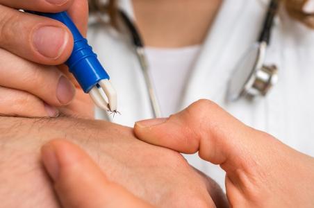 Cette alternative aux antibiotiques, développée à l'Université Duke s’avère prometteuse contre la bactérie Borrelia burgdoferi, responsable de la maladie de Lyme (Visuel Adobe Stock 152183833)