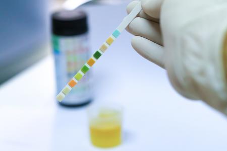Le diagnostic précoce du cancer de la vessie ou de sa récidive, sera très prochainement facilement accessible à domicile (Visuel Adobe Stock 163155094)