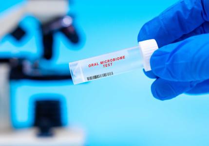 Les cancers épidermoïdes de la cavité orale survenant en l'absence de tabac, d'alcool ou de HPV constituent un sous-type moléculaire distinct, dominé par des processus mutagènes endogènes spécifiques (Visuel Adobe Stock 1667035691)