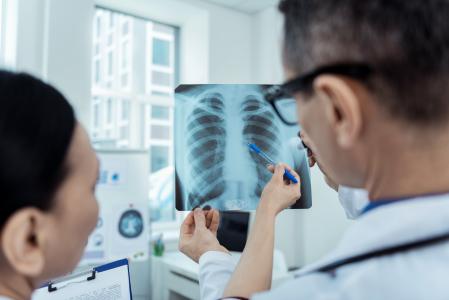 Cette étude met en lumière une complication émergente du COVID, l'aspergillose pulmonaire, une infection fongique invasive des poumons (Visuel Adobe Stock 198002919)